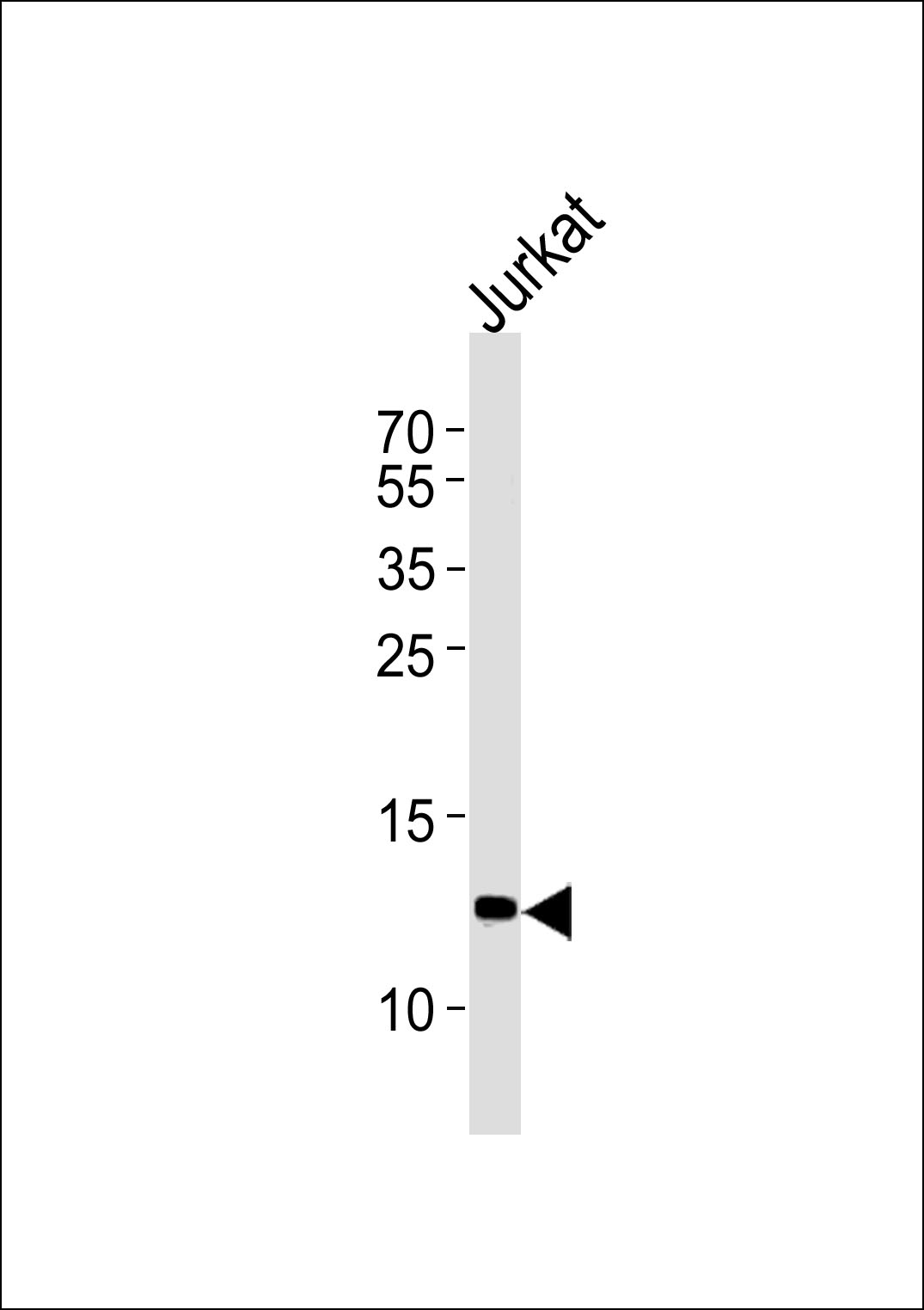 WB - B2M Antibody (C-term) AP2771b